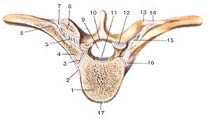  
  Рис. 73. Ребсрно-позвоночные суставы
  (articulationescostovertebralis).
  Поперечный разрез через позвоночный столб на уровне VI грудного позвонка.
  1-тело VI грудного позвонка; 2-лучистая связка головки ребра; 3-сустав головки 
  ребра; 4-головка ребра; 5-медиальная реберно-иомеречная связка; 6-бугорок ребра; 
  7-реберно-поперечный сустав; 8-попсрсчпый отросток VII грудного позвонка; 9-позвоноч-ное 
  отверстие; 10-желтая связка; II-задняя продольная связка; 12-верхний суставной 
  отросток VI грудного позвонка; 13-ребер-но-поперечный сустав. 14-реберно-поперечная 
  связка: 15-медиальная реберно-поперечная связка; 16-лучистая связка головки 
  ребра; 17-передняя продольная связка.
  Fig. 73. Articulationes costovertebrales. Поперечный разрез черепа через позвоночный 
  столб на уровне
  шестого [рудного позвонка.
  1-corpus vertebrae lumbalis (LVI); 2-ligamentum radiatum capitis costae; 3-articulatio 
  capitis costae; 4-caput costae; 5-liganientum costo-transversarium mediale; 
  6-tuberculum costae; 7-articulatio costotrans-versaria; 8-processus transversus 
  vertebrae thoracicae (Th VII); 9-fora-men vertebrale; 10-ligamentum flavum; 
  ll-ligamentum longitudinale posterius; 12-processus articularis superior vertebrae 
  thoraeicae (ThVl); 13-articulatio costotransversaria; 14-ligamentum tuberculi 
  costae; 15-ligamenium costotrans-versarium mediale; 16-ligamentum radiatum eapitis 
  costae; 17-ligamentum longitudi-nale anterias.
  Fig. 73. Costovertcbral joints.
  Transverse sectoin of vertebral column at the level VI thoracic vertebra, l-body 
  of the VI thoracic vertebra; 2-radiate ligament of head ofrib; 3-joint ol'head 
  ofrib; 4-head ofrib; 5-medial costotransverse ligament; 6-tubercle ot rib; 7-coslotransverse 
  joint; 8-transverse process ol the VII thoracic vertebra; 9-vertebral foramen; 
  10-ligamenta flava; 11-posterior longitudinal ligament; 12-superior articular 
  process of the VI thoracic vertebra; 13-costotransverse joint; 14-costotransversal 
  ligament; I5-medial costotransverse ligament; 16-radiatc ligament of head ofrib; 
  17-postcrior longitudinal ligament.